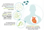 Prothena - Advancing AL Amyloidosis Treatment