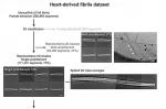 Schematic diagram of data processing workflow of heart