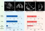 Echocardiographic and time from suspicion to diagnosis differences between women and men.