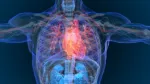 amyloidosis