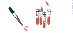 amyloidosis
