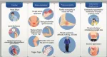 amyloidosis