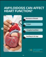 amyloidosis