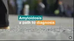amyloidosis