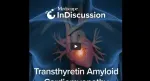 amyloidosis