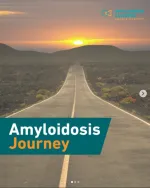 amyloidosis