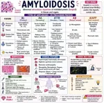 amyloidosis