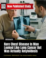 amyloidosis