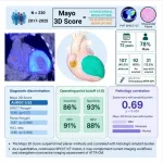 amyloidosis