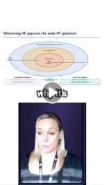 amyloidosis
