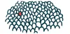 amyloidosis