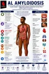 amyloidosis