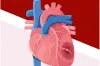 amyloidosis