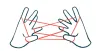 amyloidosis