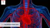 amyloidosis