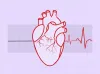 amyloidosis