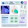 amyloidosis